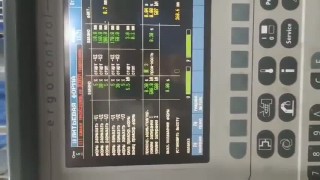 Термопластавтомат DEMAG ergotech 80-430 Extra в Минске