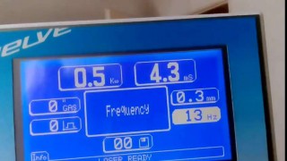 ЛАЗЕРНЫЙ СВАРОЧНЫЙ АППАРАТ OROTIG TOP TWELVE